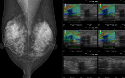 Medizinische Monitore erfüllen hohe Anforderungen
